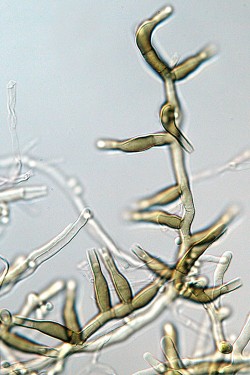 Fialidy (buňky produkující nepohlavní spory – konidie) anamorfního stadia  H. pseudoalbidus. Foto O. Koukol