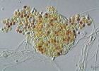 Prasklá plodnice s vřecky naplněnými askosporami je výsledkem pohlavního rozmnožování druhu Eurotium repens. 