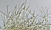 Na povrchu kolonie xerofilní houby Wallemia sebi se tvoří tetrády zpočátku krychlovitých, později téměř kulovitých konidií.