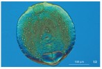 Larva (metacerkarie) motolice rodu Diplostomum z očí kaprovitých ryb (Cyprinidae). Foto S. Georgieva