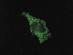 Imunofluorescenční detekce produkce kapsidového proteinu A viru bramboru nesoucího epitop z L2 proteinu lidského papillomaviru v savčích buňkách. Foto D. Pokorná