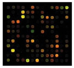 Pohled na část čipu nesoucího sekvence lidských genů. Vyhodnocení aktivity genů se provádí na základě analýzy fluorescence v jednotlivých bodech. Foto A. Čížková / © A. Čížková