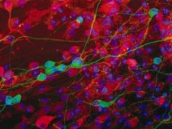 Směs diferencovaných nervových buněk - neuronů, astroglií a oligodendroglií. Nervové kmenové buňky izolované z fétů miniprasete byly indukovány k diferenciaci vysazením na povrch potažený fibronektinem a přidáním kyseliny retinové. Pomocí imunofluorescenčního značení byly zeleně obarveny buňky diferencované v neurony. Foto P. Vodička / © P. Vodička