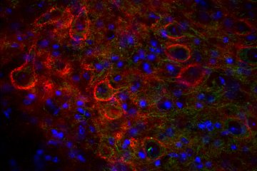 Centrum rekonstrukčních neurověd – NEURORECON hledá do svého týmu PhD studenta