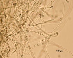 Hyfy původce račího moru Aphanomyces astaci rostoucí v laboratorní kultuře. Na konci sporangií téměř nerozeznatelných od ostatních vláken se za příhodných podmínek objevují shluky cyst, z nichž se později do vody uvolňují nepohlavní zoospory. Tento typ sporulace je typický pro celý rod Aphanomyces.  Na hyfách ani na sporangiích nenajdeme žádné morfologické znaky, na jejichž základě by bylo možné druh odlišit od druhů příbuzných. A. astaci je definován  především na základě parazitace na ra­cích. To značně komplikuje diagnostiku původce račího moru, která byla před vyvinutím molekulárních detekčních metod založena na složité kultivaci a nezbytném následném ověření  infekčnosti získaných izolátů  pro citlivé druhy raků. Foto E. Kozubíková-Balcarová