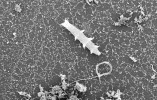 Neurčený druh želvušky izolované z listové hrabanky. Viditelné jsou končetiny s drápky a zatažený bukální (tvářový) aparát. Elektronový mikroskop (SEM), zvětšení 190×. Foto M. Czerneková