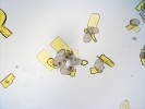 Krystaly kyseliny vulpinové vzniklé při mikrokrystalizačních testech.  Tato látka způsobuje výrazně žluté  zabarvení některých lišejníků  a je jedovatá. Foto W. Obermayer