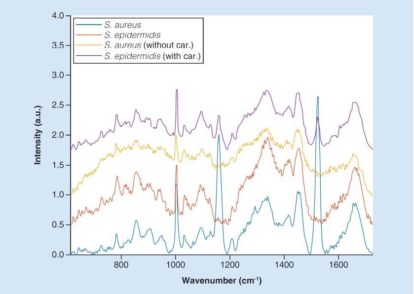 Examples of Raman spectra