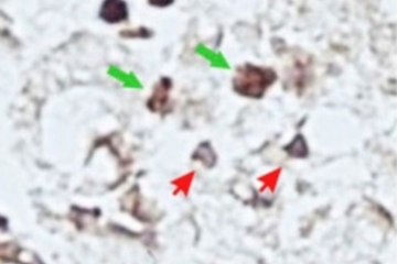 Polyfenol epigallocatechin-3-galát ze zeleného čaje moduluje zánětlivou odpověď