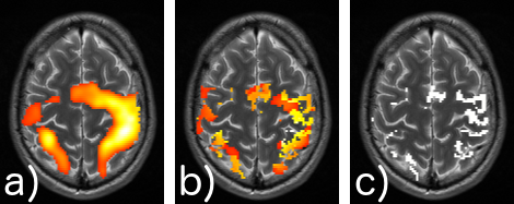 Signal detection in fMRI Signal detection in fMRI