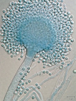 Při kultivaci kropidláku Aspergillus flavus na agarových živných půdách vznikají charakteristické kolonie s množstvím nepohlavních spor (konidií) tvořených na konidioforech. Foto A. Kubátová