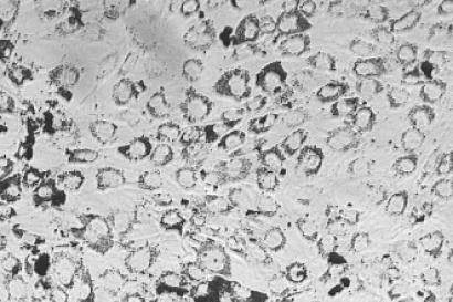 Působení nanočástic kobaltnato-zinečnatého feritu obaleného oxidem křemičitým na DNA, lipidy a proteiny mesenchymálních kmenových buněk z kostní dřeně potkanů