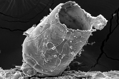 Hydroxyapatite as a product of the degradation of magnesium wire in synthetic cell culture medium. 