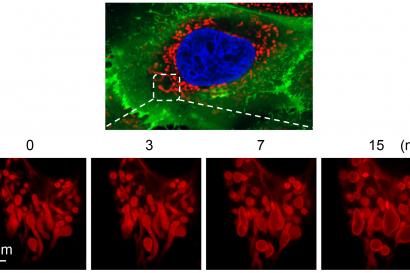 Interval imagining of mitochondrial damage in liver cells, provided with a superresolution spinning disc microscope.