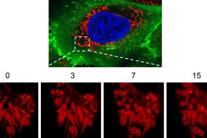 Interval imagining of mitochondrial damage in liver cells, provided with a superresolution spinning disc microscope.