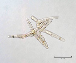 Tetraradiátní konidie (se čtyřmi rameny) neznámého druhu rodu Tripospermum (Ascomycota). Pátým ramenem byla konidie přichycena k myceliu. Foto O. Koukol