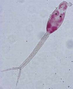 Cerkárie schistozomy Gigantobilharzia sp. z plže svinutce zploštělého (Anisus vortex). Foto J. Rudolfová
