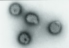 Virus chřipky typu A na snímku z elektronového mikroskopu.  Foto J. Schramlová