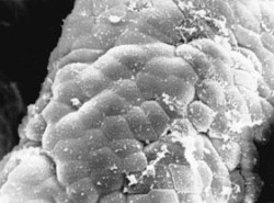 Koncová část tenkého střeva bez­mikrobního selete v rastrovacím elektronovém mikroskopu 24 hodin po infekci bakterií Salmonella enterica (serovar Typhimu­rium). Klky jsou pokryty zbytky poškozených buněk a stovkami bakterií (malé bílé tečky). Salmonely jsou velmi úspěšné v dezinformaci imunity, což jim umožnilo přestup přes střevní bariéru a nitrobuněčný parazitismus. Zvětšení 1 050x.  Orig. I. Trebichavský a O. Kofroňová  / © Orig. I. Trebichavský a O. Kofroňová