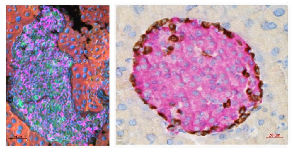 Laboratory of Pancreatic Islet Research