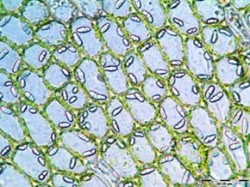 Siličná tělíska v detailu buněčné sítě játrovky trsenky okrouhlé (Jungermannia sphaerocarpa) upoutají svým zářivým vzhledem. Foto Z. Soldán / © Photo