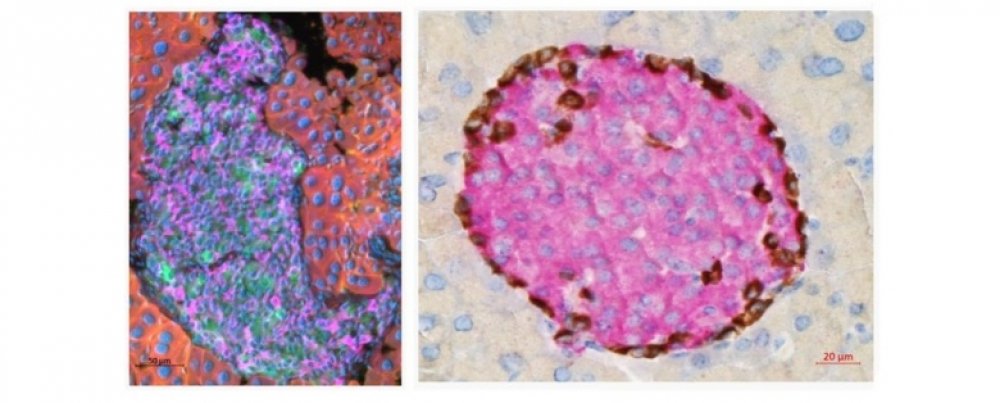 Laboratory of Pancreatic Islet Research