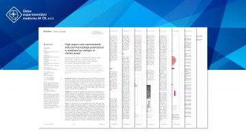 V prestižním časopise Frontiers in Immunology (IF 8,786) vyšla nová studie vědců z Oddělení genetické toxikologie a epigenetiky