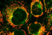 Barevné značení mitochondrií (oranžová barva) a modelové sloučeniny (zelená barva) pomocí nové bioortogonalní reakce v rakovinové buněčné linii.