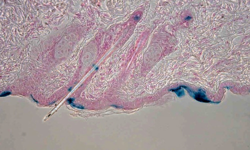 lacZ staining of the transgenic mouse hair follicles contrastained with Nuclear Fast Red