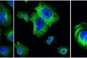 Účinek dolastatinů na rakovinné buňky: zleva cytoskelet nepoškozených rakovinných buněk v kultuře, uprostřed cytoskelet rakovinných buněk poškozený dolastatiny ze sinic, vpravo srovnání s účinkem známého cytostatika taxolu z tisu červeného
