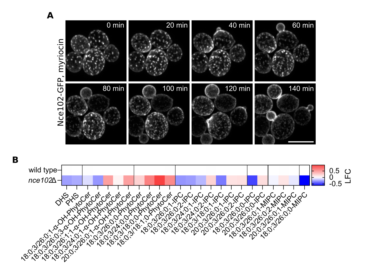 Mikroskopické snímky a schéma distribuce proteinu Nce102-GFP. Detailní popis naleznete pod obrázkem.