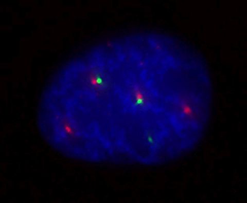 Lokalizace Geminu3 v jádře lidské buňky. Gemin3 označen zeleně, Cajalova tělíska červeně a DNA modře. Zdroj: Adriana Roithová, Ústav molekulární genetiky AV ČR, v. v. i.