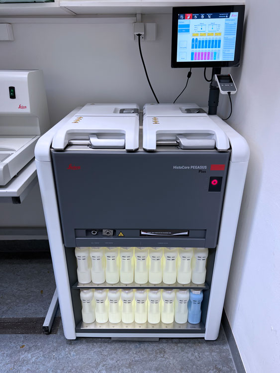 Tissue Processor HistoCore PEGASUS