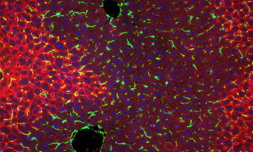 Játra - hepatocyty kolem portální žíly v jaterním parenchymu, Hoechst (modrá; jádra), Desmin (zelená; jaterní Itovy buňky) a E-Cadherin (červená; hepatocyty kolem portální žíly v jaterním parenchymu)