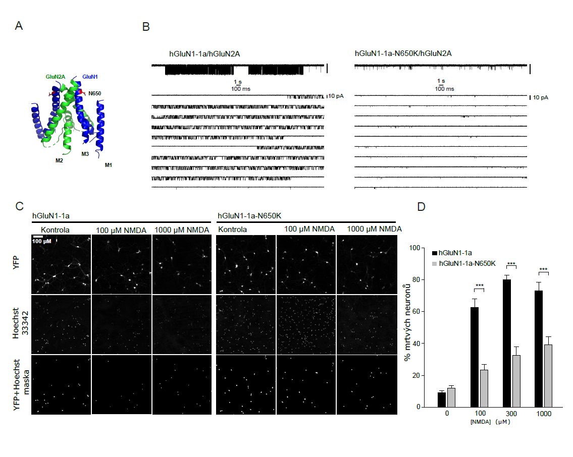 Reprezentativní snímky fluorescence YFP a Hoechst 33342 v hipokampálních neuronech s výsledkovými grafy. Detailní popis naleznete pod obrázkem.