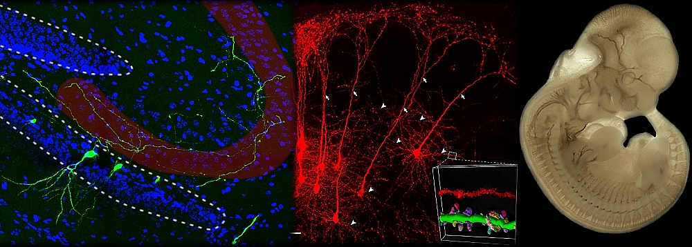 Laboratory of Molecular Neurobiology