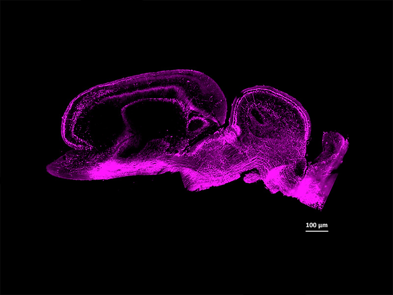 Mikrofotografie s vysokým rozlišením ukazující prostorovou distribuci dopaminergních neuronů a inervací v mozku madagaskarského pozemního gekona (Paraedura picta)